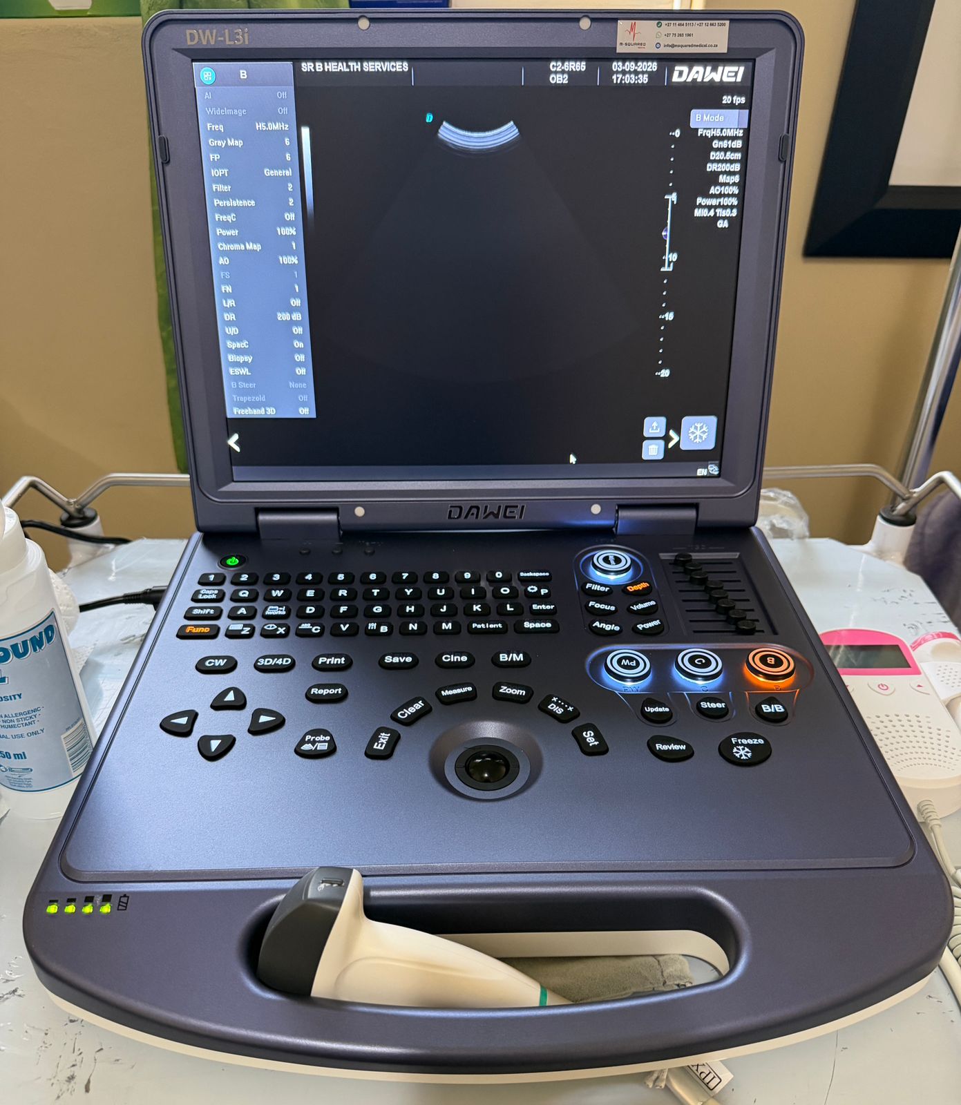 The new DAWEI sonar machine at SisterB Health Services, ready for a scan