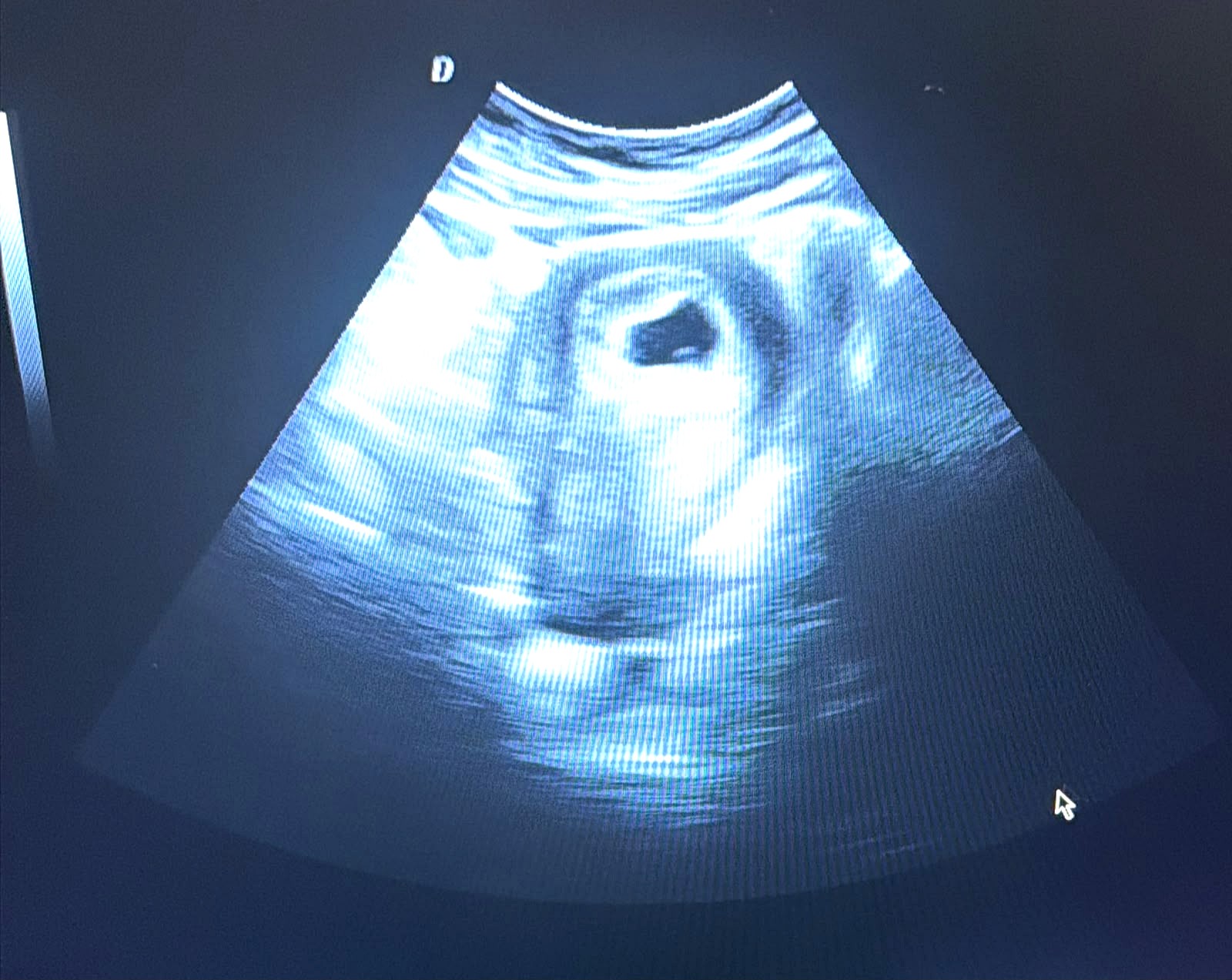 Early pregnancy ultrasound scan performed with the new sonar technology at SisterB Health Services